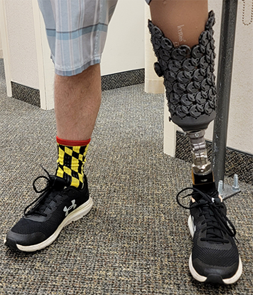 Prosthetics: A Better Fit | A. James Clark School of Engineering ...